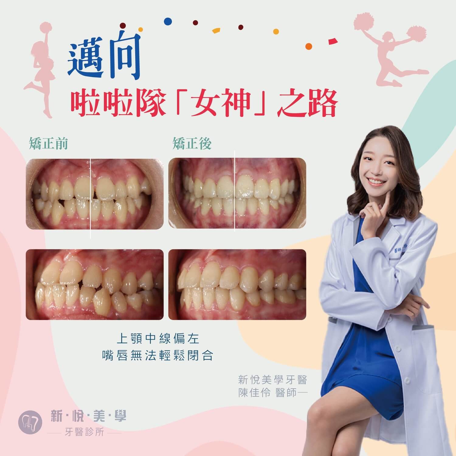 新悅美學牙醫診所的案例分享圖片